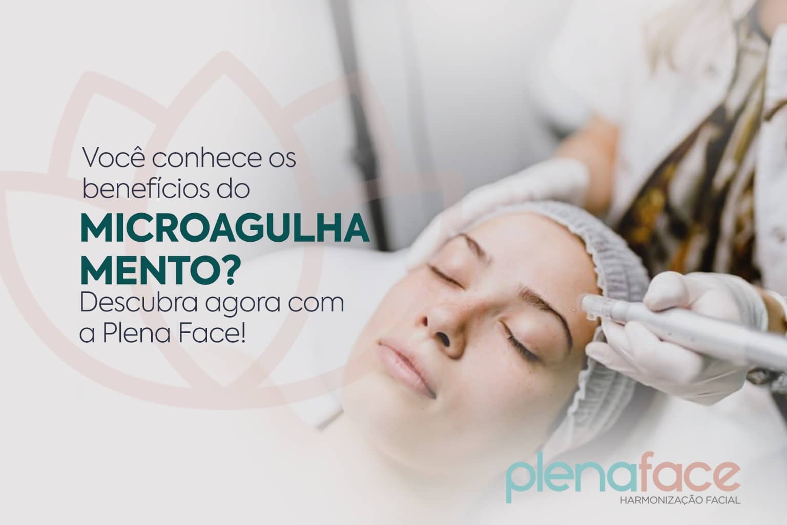 Você conhece os benefícios do microagulhamento? Descubra agora com a ...